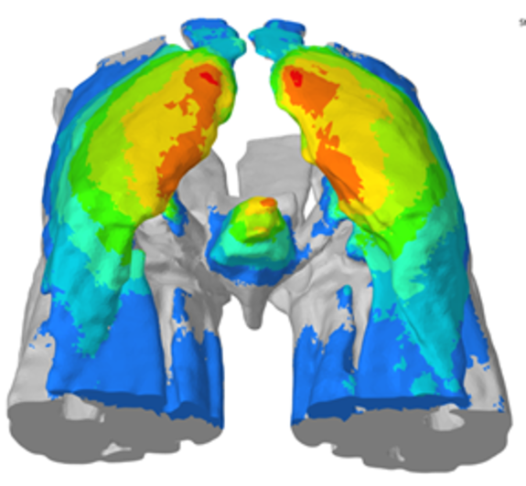 Bild zu Merkle & Partner Medizinprodukte Simulation Lunge